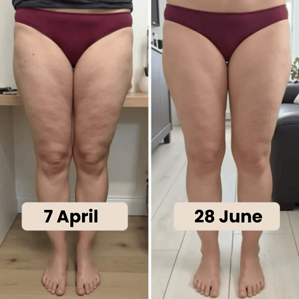 LM0000000226_7